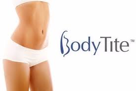 BodyTite liposuction